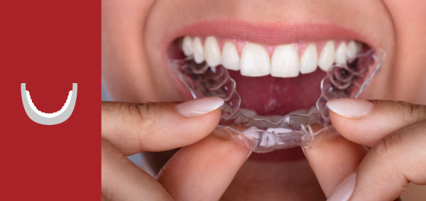 Dental Aligners in Dedham