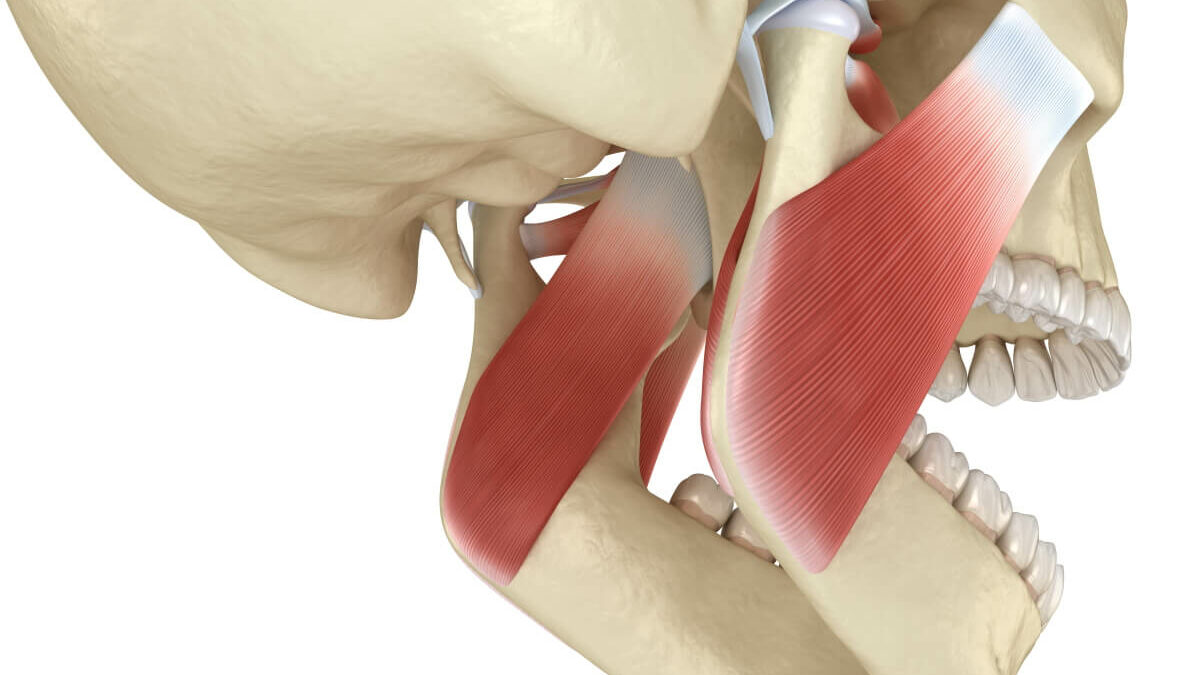 How to cure TMJ permanently.