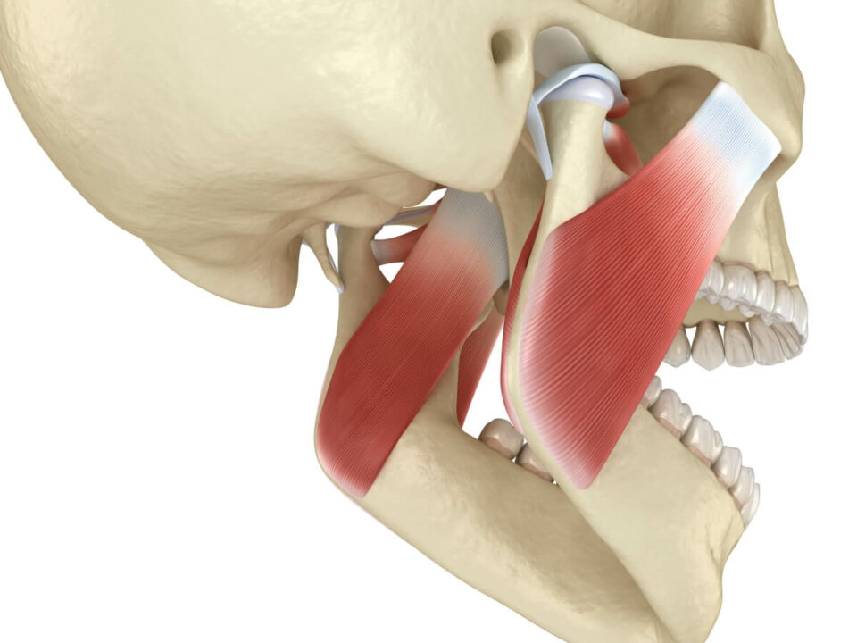 How to cure TMJ permanently.