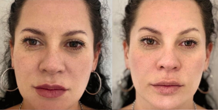 Case-4-Before-and-After-2-Tx